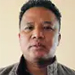 International patient sharing medical tourism success story